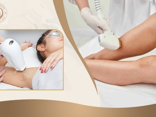 professional-permanent-hair-removal-services