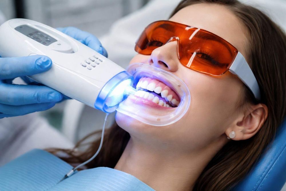 teeth-whitening-in-abbotsford-professional-smile-brightening-big-0