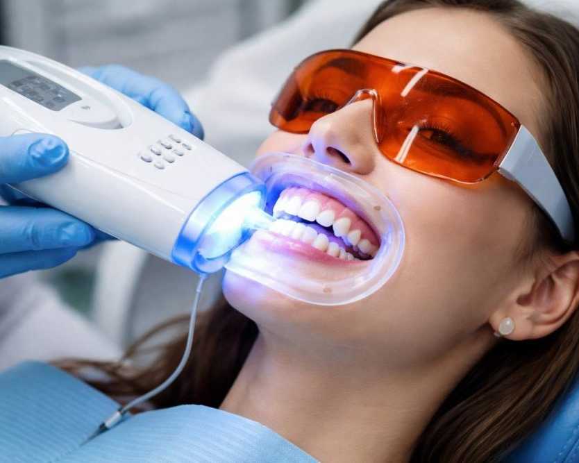 teeth-whitening-in-abbotsford-professional-smile-brightening