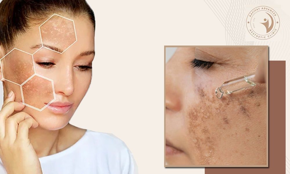 aafiyat-treatments-for-brightening-hyperpigmentation-big-0