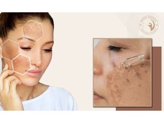 aafiyat-treatments-for-brightening-hyperpigmentation-small-0
