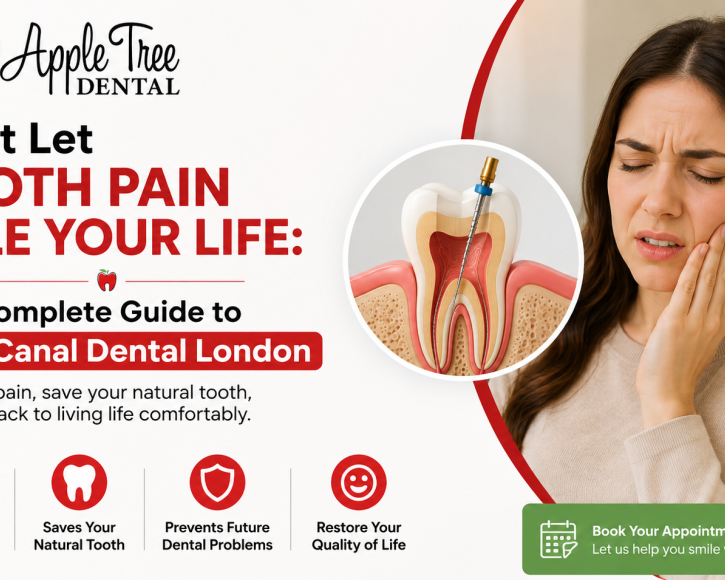 emergency-root-canal-in-london-on-fast-pain-relief-today