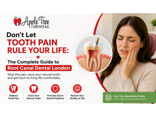 emergency-root-canal-in-london-on-fast-pain-relief-today-small-0