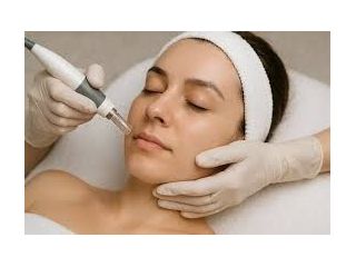 micro-needling-for-smoother-healthier-skin-small-0