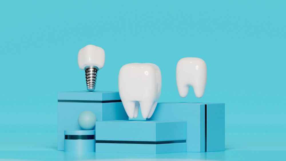 dental-implants-etobicoke-book-your-consultation-today-big-0