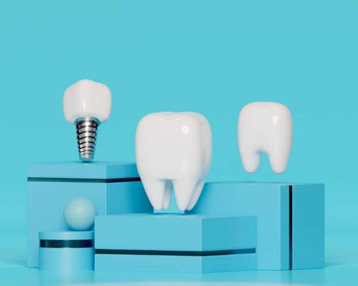 dental-implants-etobicoke-book-your-consultation-today