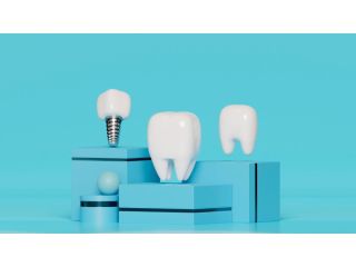 dental-implants-etobicoke-book-your-consultation-today-small-0