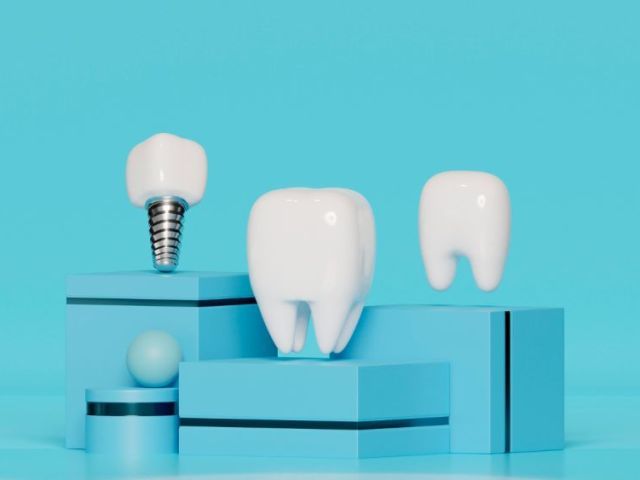 dental-implants-etobicoke-book-your-consultation-today