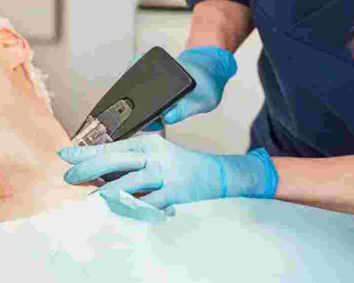 exosome-hair-growth-treatment