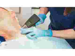 exosome-hair-growth-treatment-small-0