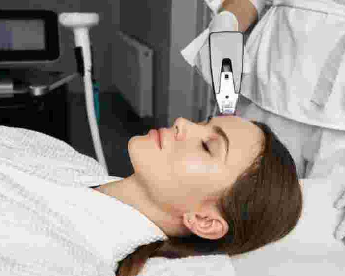 photofacial-treatment-mississauga