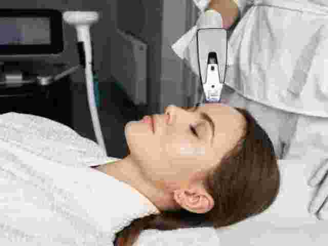 photofacial-treatment-mississauga