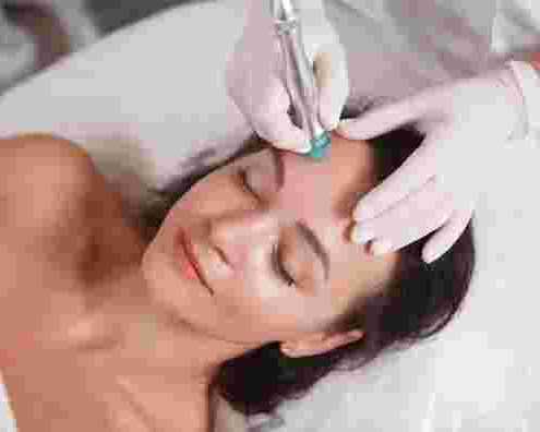 hydrafacial-burlington