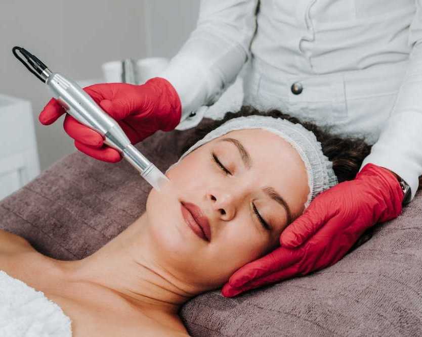 microneedling-with-procell-therapies-for-smoother-healthier-skin