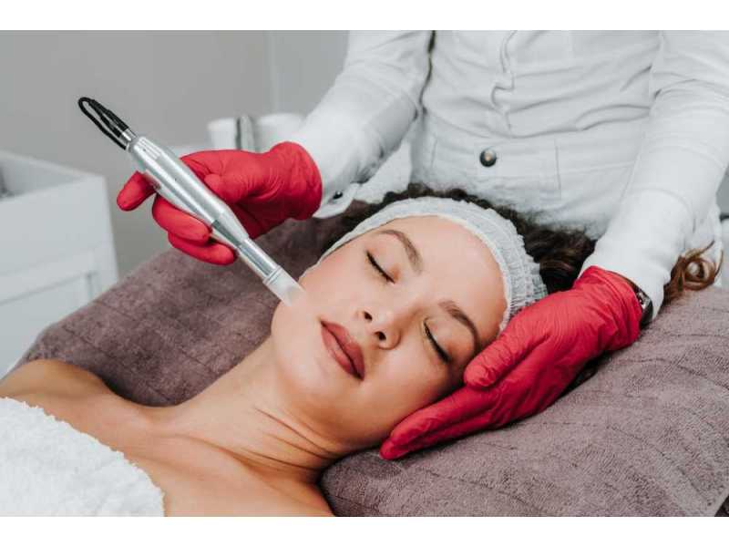 microneedling-with-procell-therapies-for-smoother-healthier-skin-small-0
