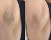 best-brazilian-waxing-in-edmonton