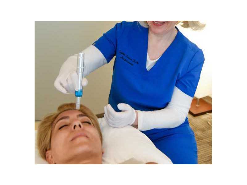 restore-your-skin-naturally-with-microneedling-in-markham-small-0