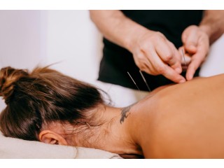 Acupuncture Toronto: A Holistic Approach to Healing