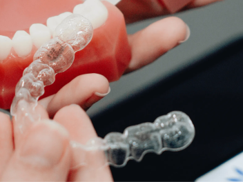 best-invisalign-clear-aligners-for-teeth-straightening-chesham-uk