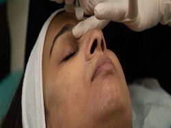 led-phototherapy-treatment