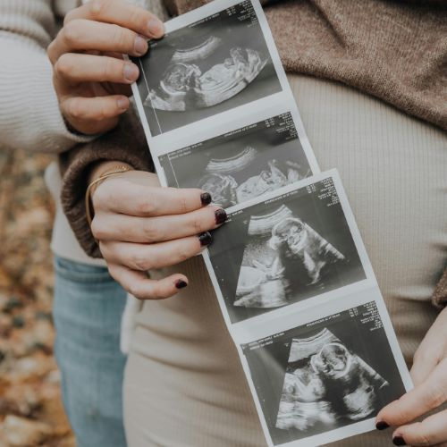 experience-advanced-pregnancy-scans-at-window-to-the-womb-watford-big-2