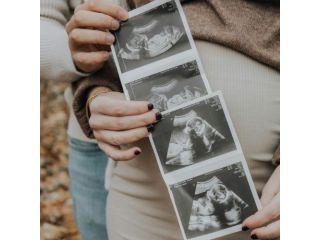 experience-advanced-pregnancy-scans-at-window-to-the-womb-watford-small-2