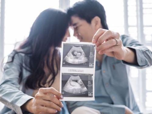 best-4d-baby-scanning-clinic-in-aylesbury-book-today