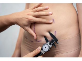 abdomen-suture-suspension-lift-chiswick-call-02036330332-small-0
