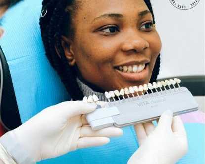 why-choose-chess-house-dental-practice-for-teeth-whitening