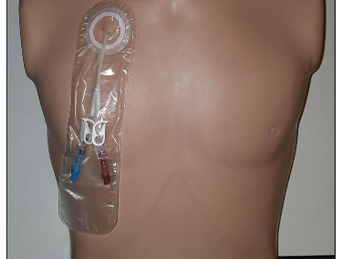 trusted-specialist-urology-products-in-london
