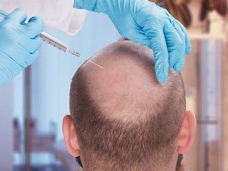 hair-transplant-clinic-manchester-get-your-hair-back-today