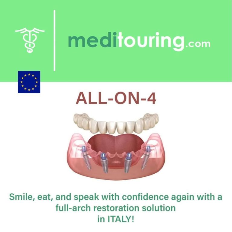 all-on-4-dental-implants-abroad-affordable-smile-makeover-big-0