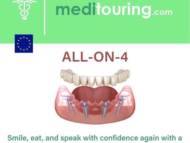 all-on-4-dental-implants-abroad-affordable-smile-makeover