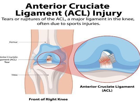 acl-injury-treatment-by-specialist-knee-surgeon