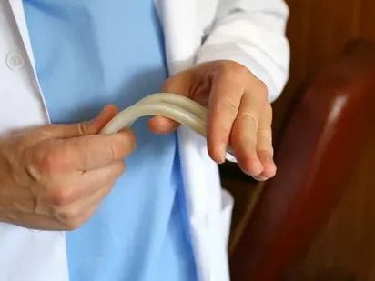 best-penile-implant-surgeon-in-london-for-safe-results