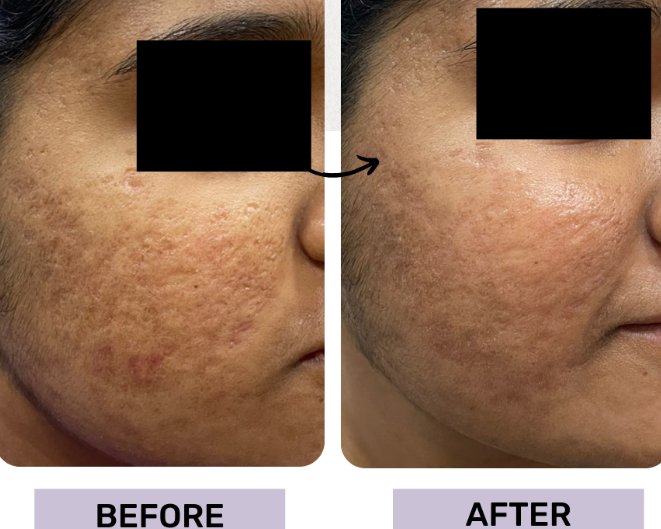 skin-treatment-clinic-maidenhead-call-us-02036330332