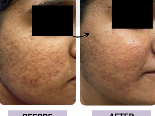 skin-treatment-clinic-maidenhead-call-us-02036330332