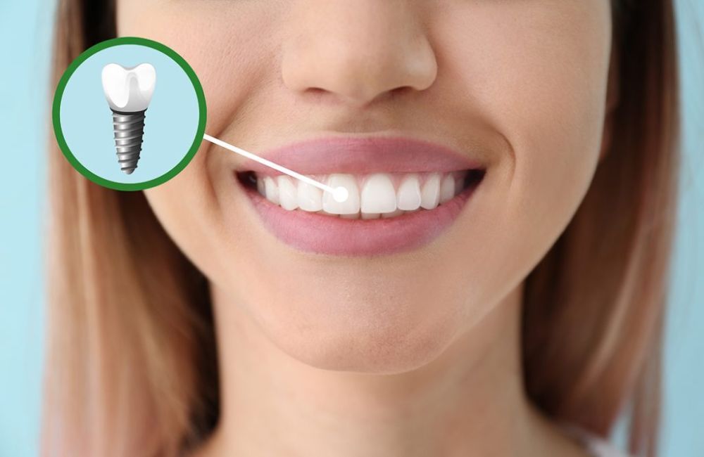 expert-dental-care-at-confidental-care-bromley-big-0
