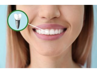expert-dental-care-at-confidental-care-bromley-small-0