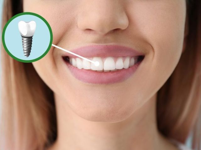 expert-dental-care-at-confidental-care-bromley