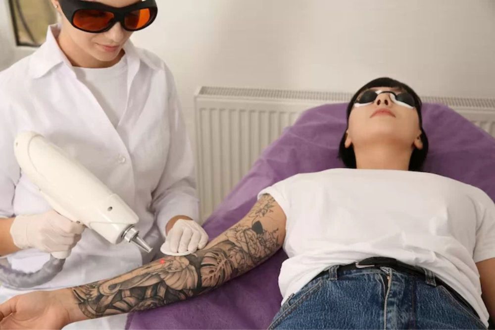 affordable-laser-tattoo-removal-for-all-skin-types-by-experts-big-0