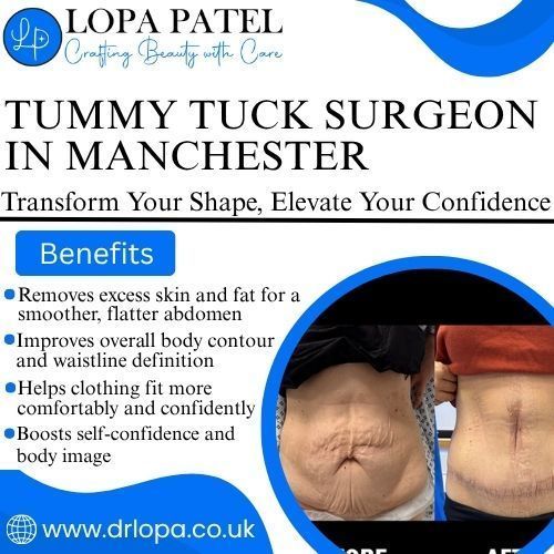 best-tummy-tuck-surgeon-in-manchester-big-0