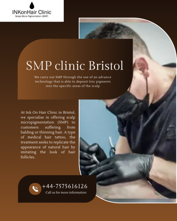 best-smp-uk-smp-clinic-uk-hair-tattoo-big-0