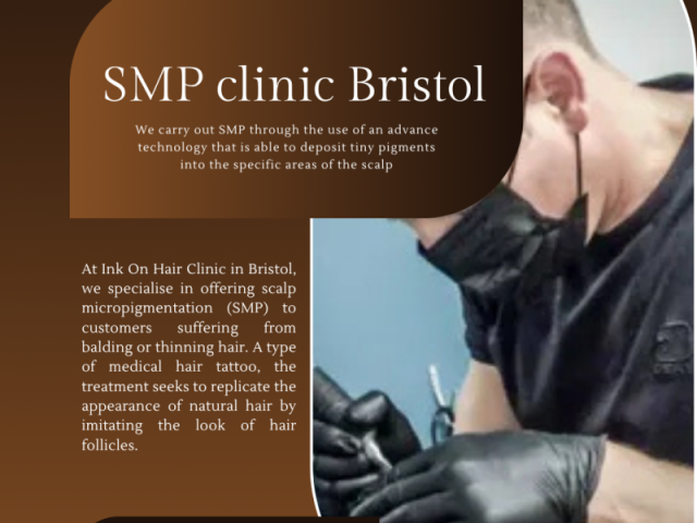 best-smp-uk-smp-clinic-uk-hair-tattoo