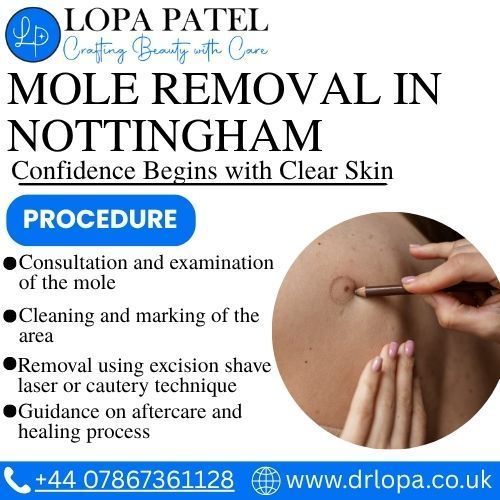mole-removal-in-nottingham-big-0