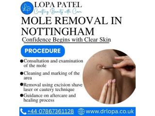 mole-removal-in-nottingham-small-0