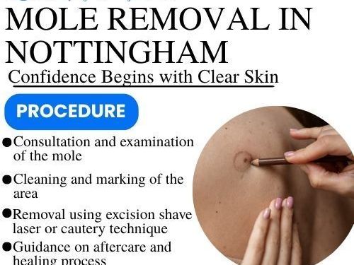 mole-removal-in-nottingham