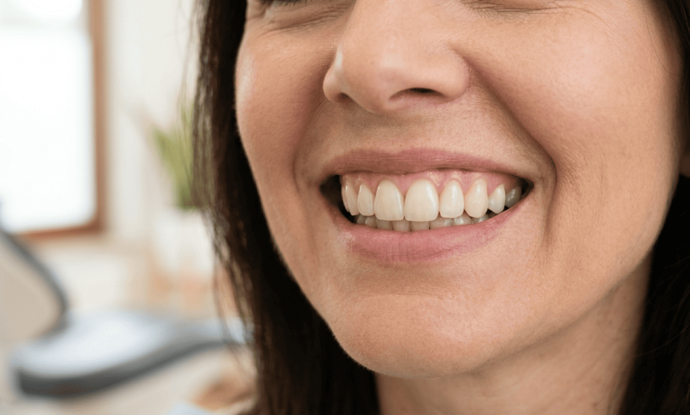 cosmetic-dentist-in-poole-transform-your-smile-with-expert-care-big-0