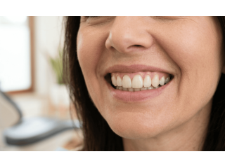 cosmetic-dentist-in-poole-transform-your-smile-with-expert-care-small-0