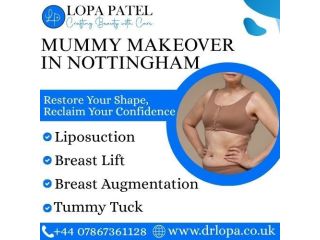 mummy-makeover-in-nottingham-small-0
